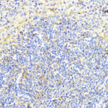 DNMT1 Rabbit Polyclonal Antibody - Image 3