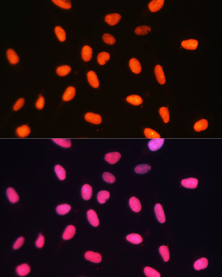 DNMT1 Rabbit Polyclonal Antibody - Image 4