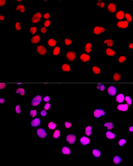 DNMT1 Rabbit Polyclonal Antibody - Image 2