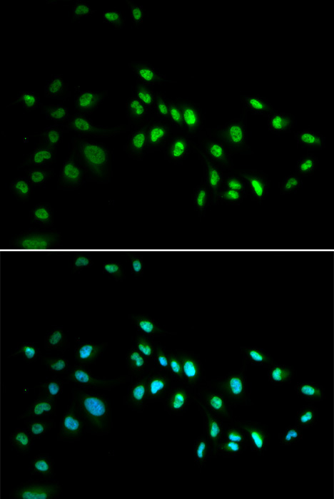 DNMT3A Rabbit Polyclonal Antibody - Image 3