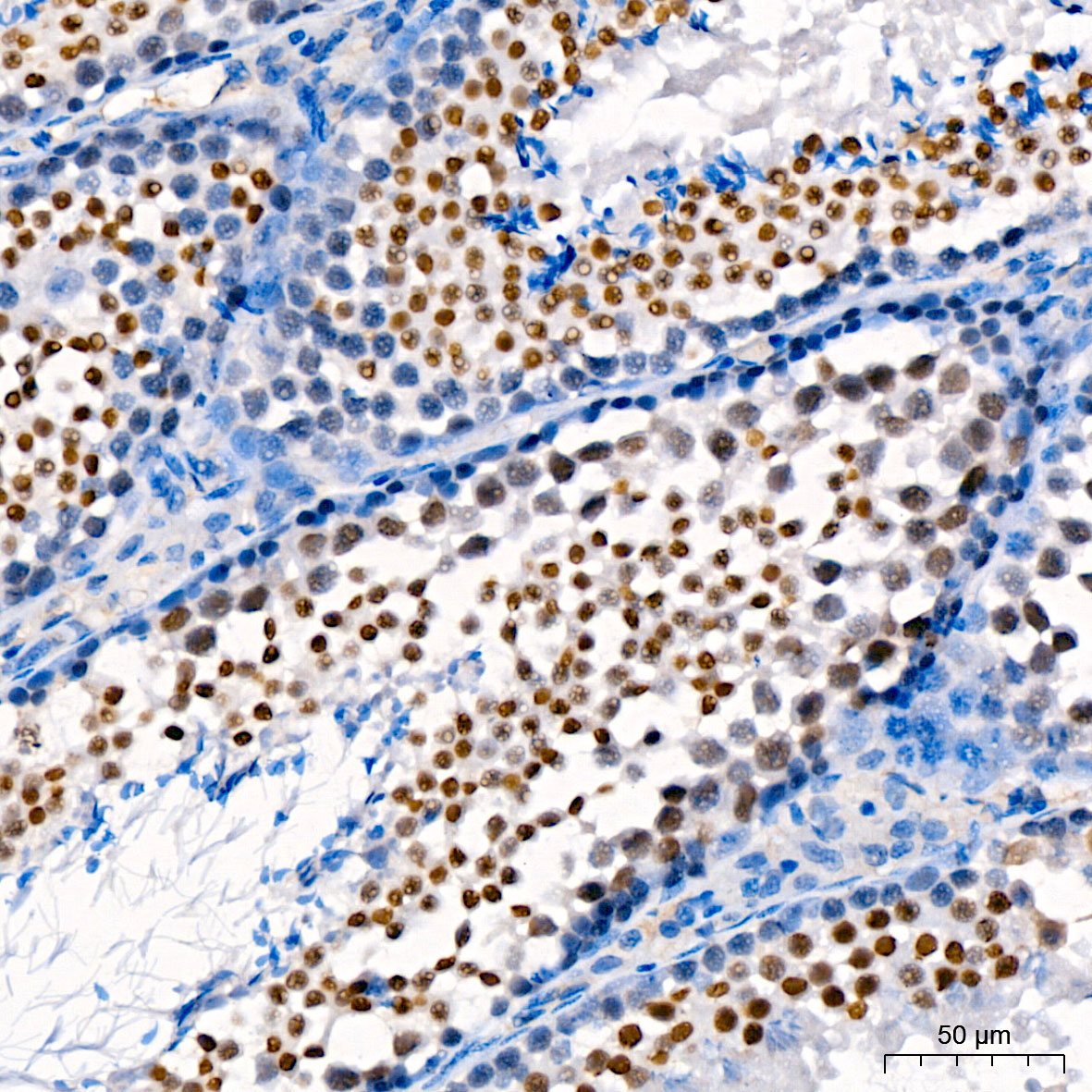 DNMT3B Rabbit Polyclonal Antibody - Image 2