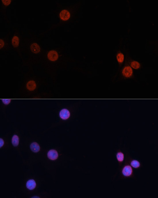DNMT3B Rabbit Polyclonal Antibody - Image 2