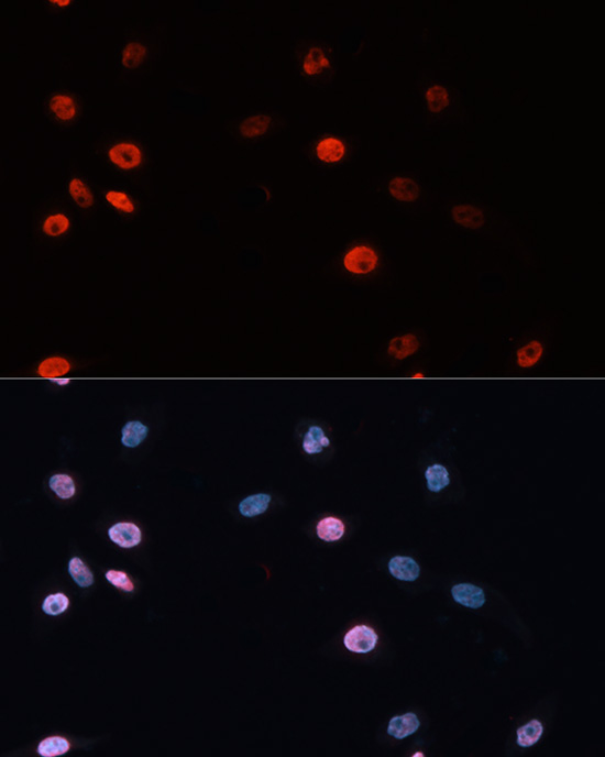 DNMT3B Rabbit Polyclonal Antibody - Image 3