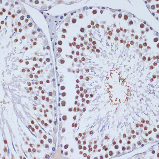 DNMT3L Rabbit Polyclonal Antibody