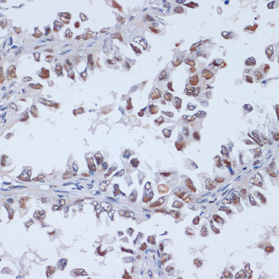 DNMT3L Rabbit Polyclonal Antibody - Image 2