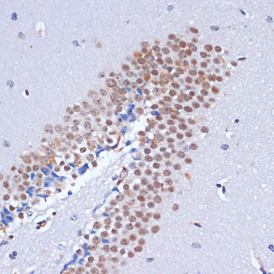 DNMT3L Rabbit Polyclonal Antibody - Image 3