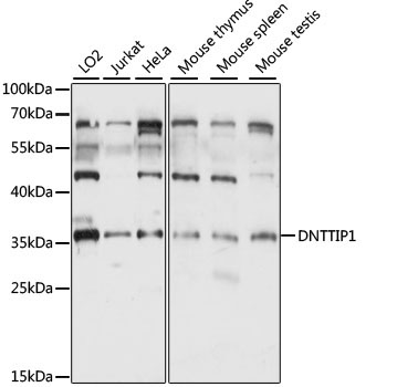 DNTTIP1 Rabbit Polyclonal Antibody