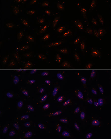 DNTTIP2 Rabbit Polyclonal Antibody - Image 2