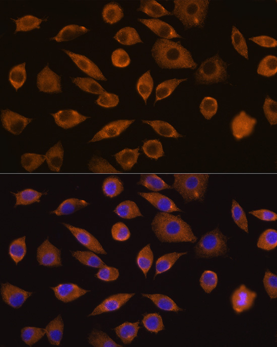 DOCK2 Rabbit Polyclonal Antibody - Image 2