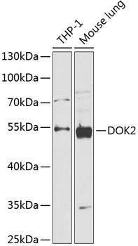 DOK2 Rabbit Polyclonal Antibody
