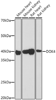 DOK4 Rabbit Polyclonal Antibody