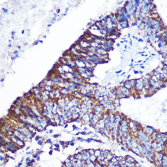 DOK4 Rabbit Polyclonal Antibody - Image 2