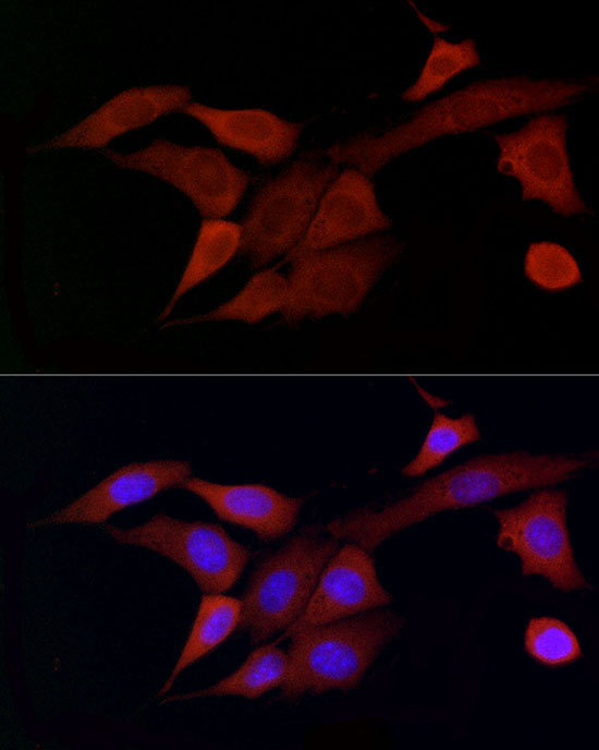 DOK4 Rabbit Polyclonal Antibody - Image 3