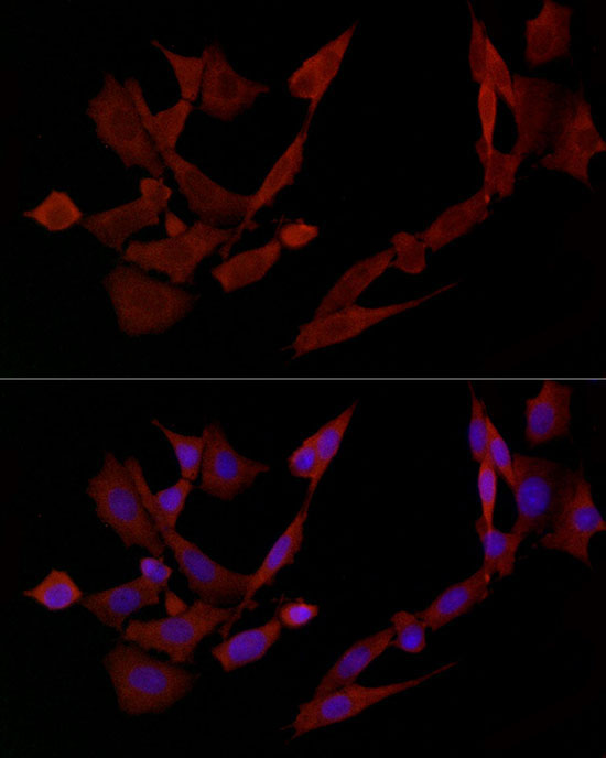 DOK4 Rabbit Polyclonal Antibody - Image 4