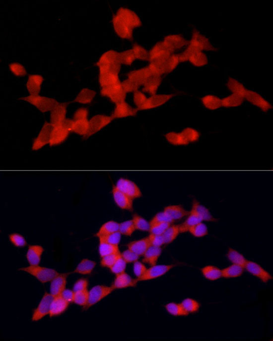 DOK4 Rabbit Polyclonal Antibody - Image 5