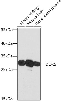 DOK5 Rabbit Polyclonal Antibody