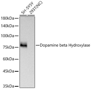 Dopamine beta Hydroxylase Rabbit Monoclonal Antibody