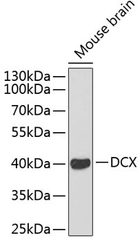 Doublecortin Rabbit Polyclonal Antibody