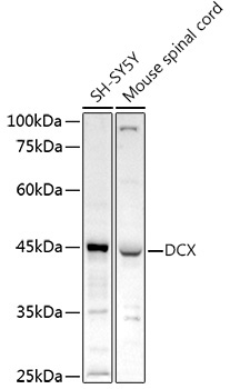 Doublecortin Rabbit Polyclonal Antibody