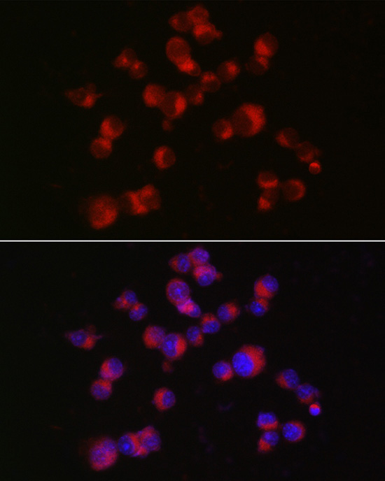 Doublecortin Rabbit Polyclonal Antibody