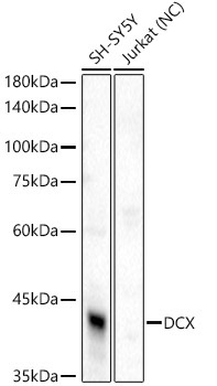 Doublecortin Rabbit Polyclonal Antibody