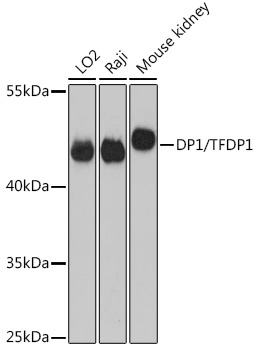 DP1/TFDP1 Rabbit Polyclonal Antibody