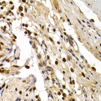 DP1/TFDP1 Rabbit Polyclonal Antibody - Image 2