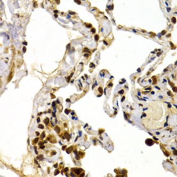 DP1/TFDP1 Rabbit Polyclonal Antibody - Image 3