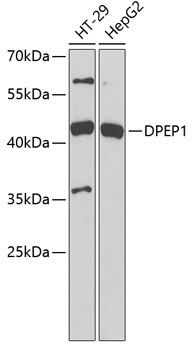 DPEP1 Rabbit Polyclonal Antibody