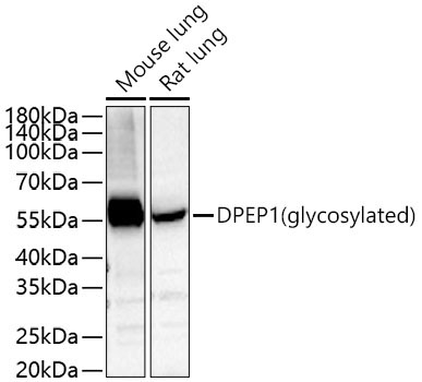 DPEP1 Rabbit Polyclonal Antibody - Image 2