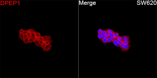 DPEP1 Rabbit Polyclonal Antibody - Image 3