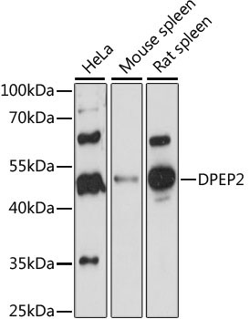 DPEP2 Rabbit Polyclonal Antibody