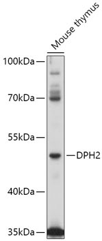 DPH2 Rabbit Polyclonal Antibody