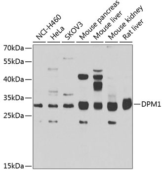 DPM1 Rabbit Polyclonal Antibody