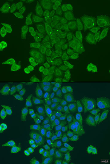 DPM1 Rabbit Polyclonal Antibody - Image 2
