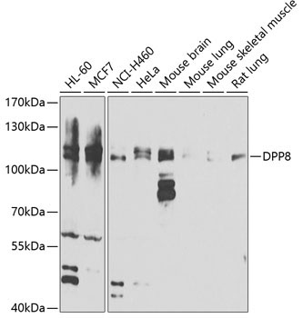 DPP8 Rabbit Polyclonal Antibody
