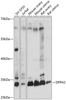 DPPA2 Rabbit Polyclonal Antibody