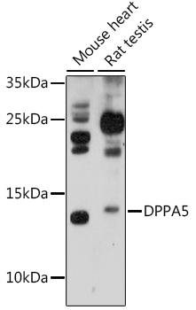 DPPA5 Rabbit Polyclonal Antibody
