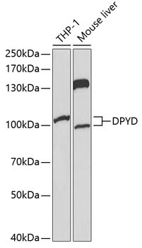 DPYD Rabbit Polyclonal Antibody