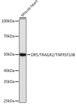 DR5/TRAILR2/TNFRSF10B Rabbit Monoclonal Antibody