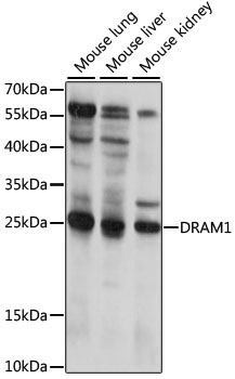DRAM1 Rabbit Polyclonal Antibody