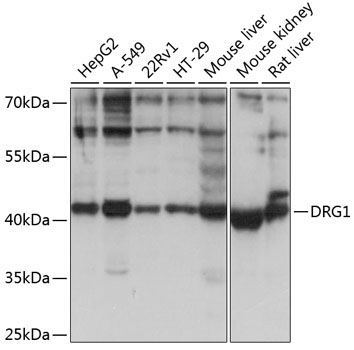 DRG1 Rabbit Polyclonal Antibody