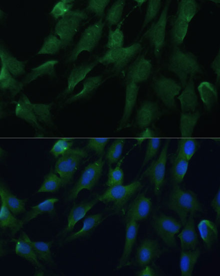 DRG2 Rabbit Polyclonal Antibody - Image 2