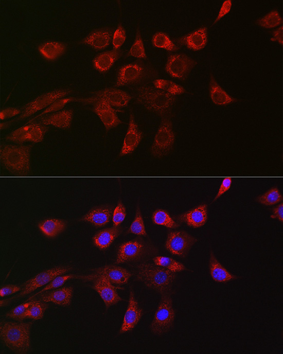 DRP1 Rabbit Polyclonal Antibody - Image 6