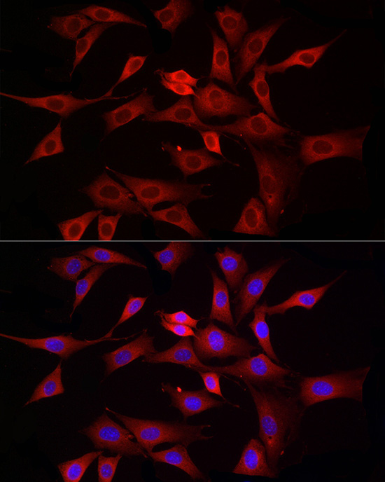 DRP1 Rabbit Polyclonal Antibody