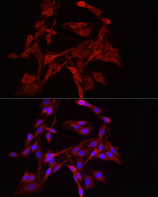 DRP1 Rabbit Polyclonal Antibody - Image 2
