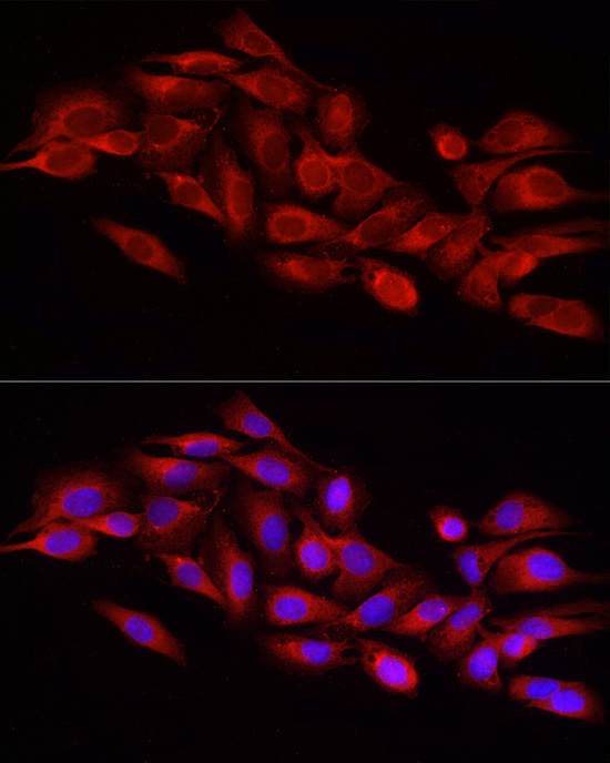 DRP1 Rabbit Polyclonal Antibody - Image 3