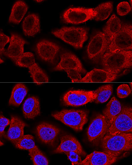 DRP1 Rabbit Polyclonal Antibody