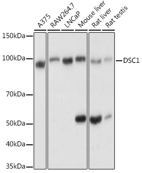 DSC1 Rabbit Polyclonal Antibody