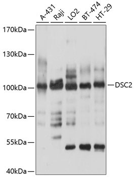 DSC2 Rabbit Polyclonal Antibody